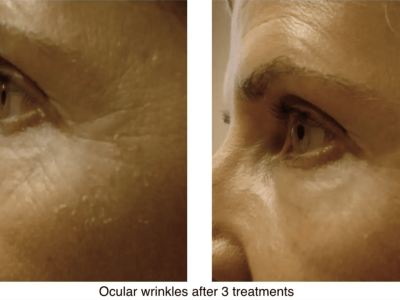 Screenshot 2025-03-04 at 3.37.31 PM-2